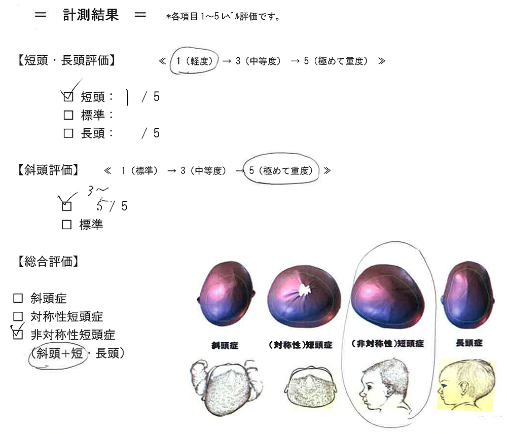 スターバンド体験記 Azurebreeze Jp